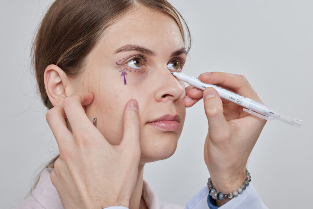 Blepharoplasty Dubai
