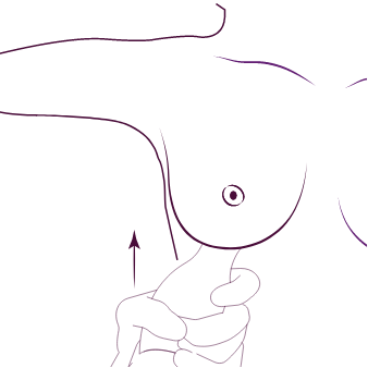 Preserve Breast AUgmentation Dubai