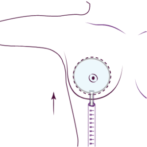Preserve Breast Augmentation Dubai