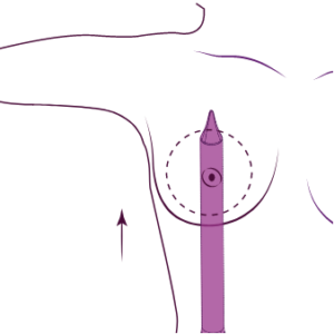 Preserve breast augmentation Dubai