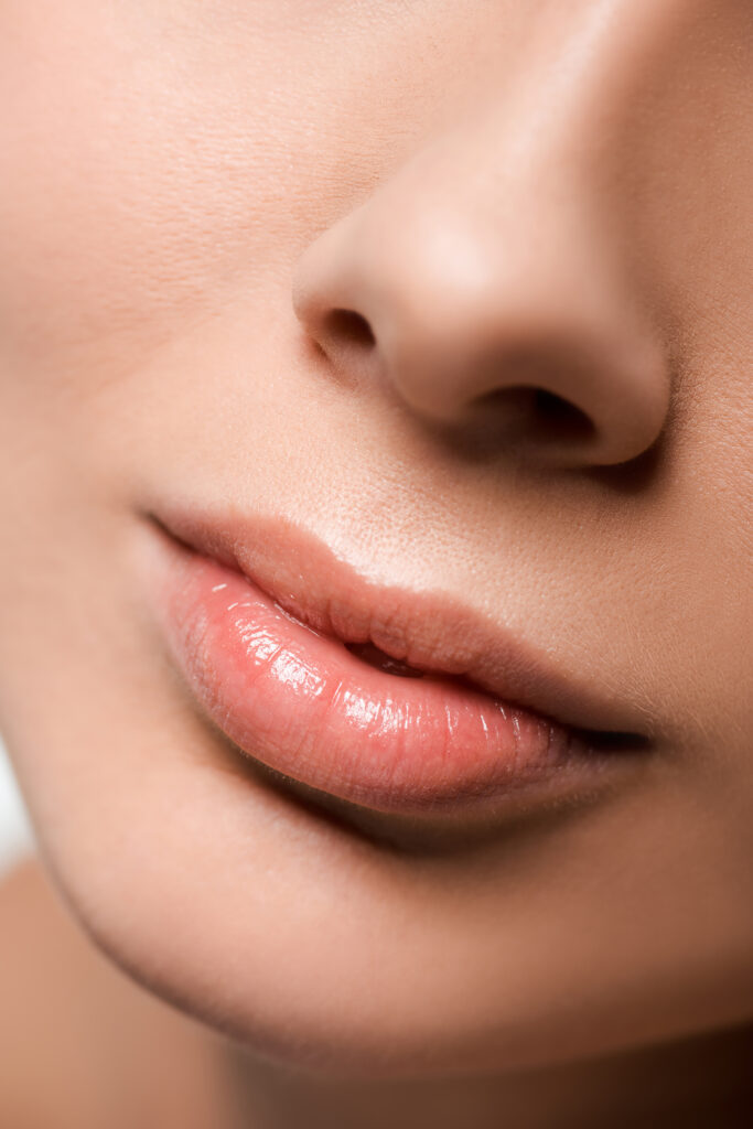 Lip Lift in Dubai
