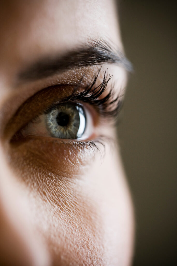 Blepharoplasty in Dubai