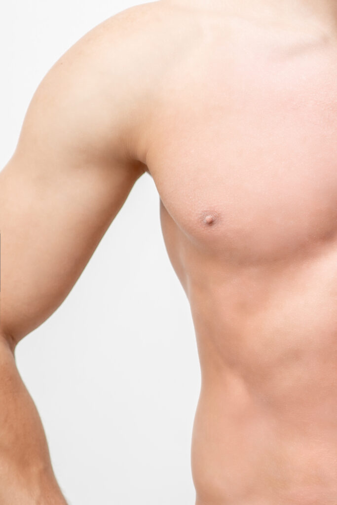 Gynecomastia Surgery in Dubai